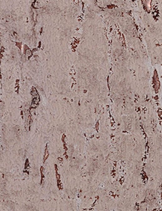 Обои Innovations Collection Marbled Cork MCO-05 ALEXANDRIA